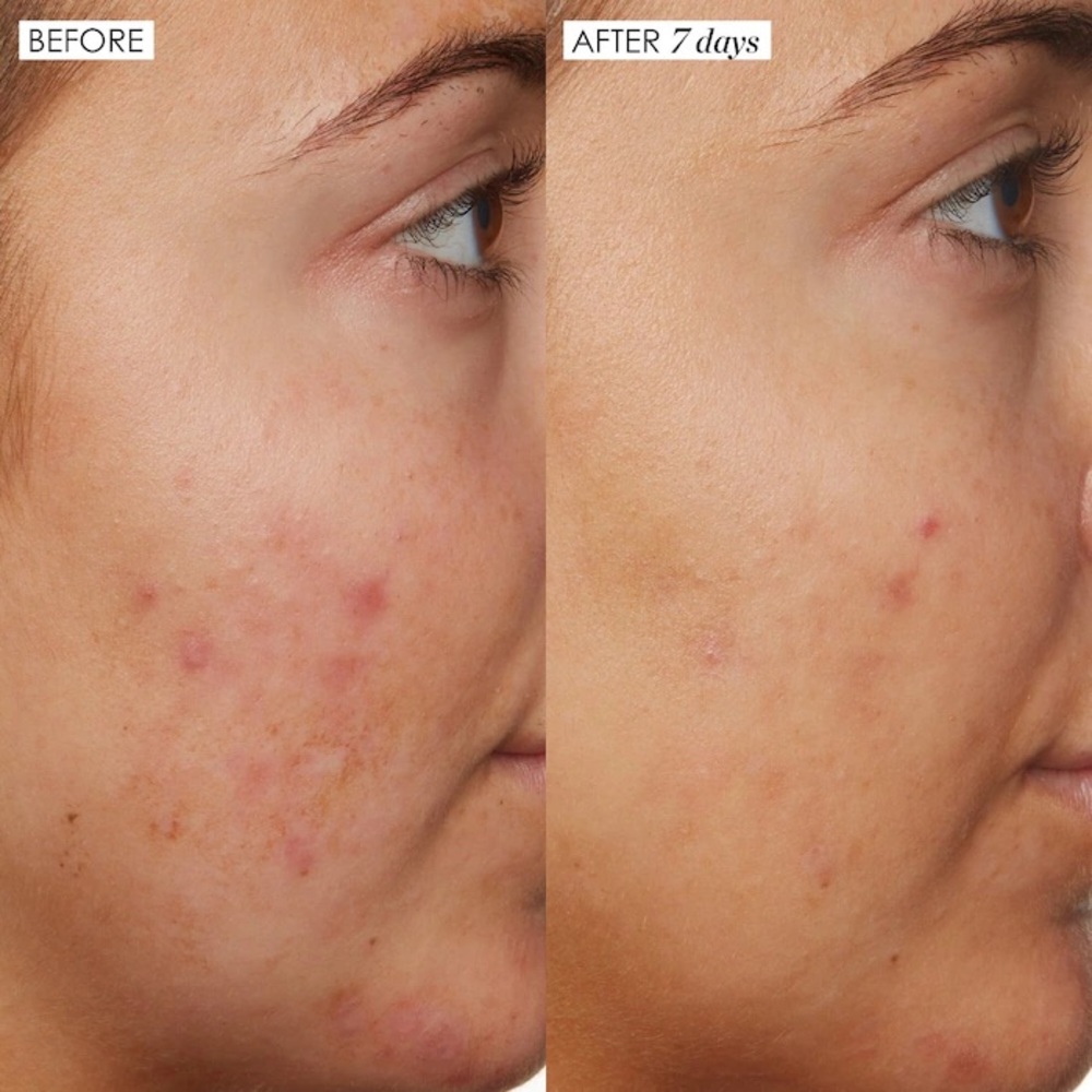 Sunday Riley Good Genes All-In-One Lactic Acid Treatment .5 FL Oz $50 Brand New - Picture 2 of 4